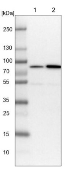PP2C gamma/PPM1G Antibody, Novus Biologicals 0.1mL; Unlabeled:Antibodies,