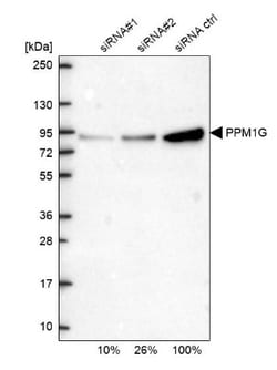 PP2C gamma/PPM1G Antibody, Novus Biologicals 0.1mL; Unlabeled:Antibodies,