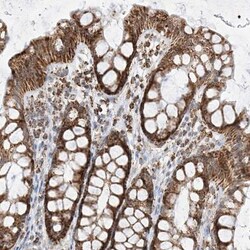 PPA2 Antibody, Novus Biologicals 0.1mL; Unlabeled:Antibodies, Polyclonal