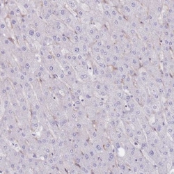 PPAP2A Antibody, Novus Biologicals 25 &mu;L | Buy Online | Novus Biologicals | Fisher Scientific