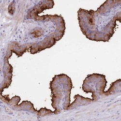 PPAP2A Antibody, Novus Biologicals 25 &mu;L | Buy Online | Novus Biologicals | Fisher Scientific