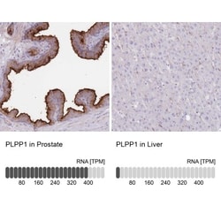 PPAP2A Antibody, Novus Biologicals 25 &mu;L | Buy Online | Novus Biologicals | Fisher Scientific