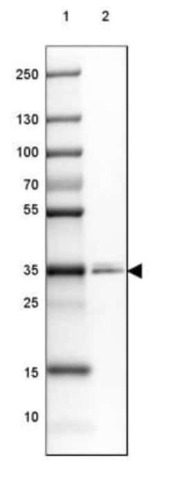 PPAP2A Antibody, Novus Biologicals 25 &mu;L | Buy Online | Novus Biologicals | Fisher Scientific