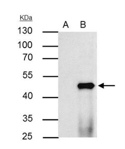 PPAR alpha/NR1C1 Antibody, Novus Biologicals 0.1 mL | Buy Online | Novus Biologicals | Fisher Scientific