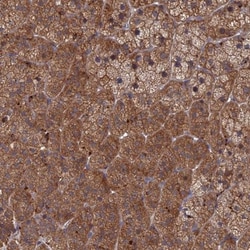 PPCDC Antibody, Novus Biologicals 25 &mu;L, Unlabeled:Antibodies, Polyclonal