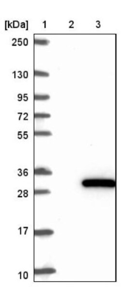 PPCDC Antibody, Novus Biologicals 25 &mu;L, Unlabeled:Antibodies, Polyclonal