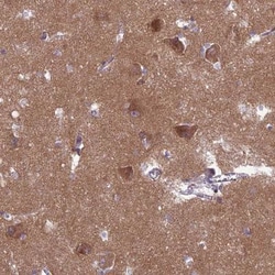 PPFIA3 Antibody, Novus Biologicals 25 &mu;L, Unlabeled:Antibodies, Polyclonal