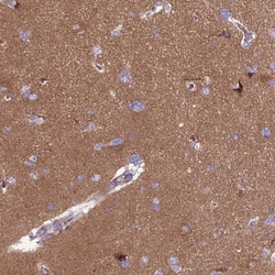PPFIA3 Antibody, Novus Biologicals 25 &mu;L, Unlabeled:Antibodies, Polyclonal