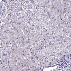 PPFIA3 Antibody, Novus Biologicals 25 &mu;L, Unlabeled:Antibodies, Polyclonal
