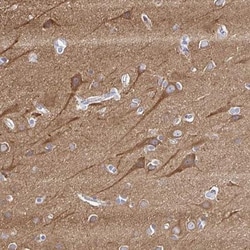 PPFIA4 Antibody, Novus Biologicals:Antibodies:Primary Antibodies