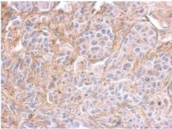 PPFIBP2 Antibody, Novus Biologicals 0.1mL; Unlabeled:Antibodies, Polyclonal