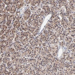 PPFIBP2 Antibody, Novus Biologicals 25 &mu;L; Unlabeled:Antibodies, Polyclonal