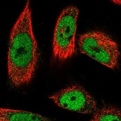 PPHLN1 Antibody, Novus Biologicals 0.1mL; Unlabeled:Antibodies, Polyclonal