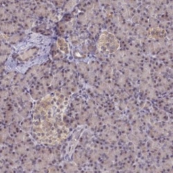 PPHLN1 Antibody, Novus Biologicals 0.1mL; Unlabeled:Antibodies, Polyclonal