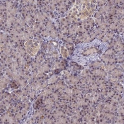 PPHLN1 Antibody, Novus Biologicals 0.1mL; Unlabeled:Antibodies, Polyclonal