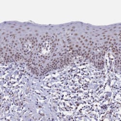PPHLN1 Antibody, Novus Biologicals 0.1mL; Unlabeled:Antibodies, Polyclonal