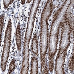 PPHLN1 Antibody, Novus Biologicals:Antibodies:Primary Antibodies