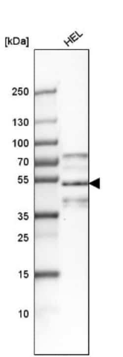 PPHLN1 Antibody, Novus Biologicals 0.1mL; Unlabeled:Antibodies, Polyclonal