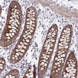 PPIH Antibody, Novus Biologicals 0.1mL; Unlabeled:Antibodies, Polyclonal
