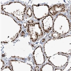 PPIL2 Antibody, Novus Biologicals 0.1mL; Unlabeled:Antibodies, Polyclonal