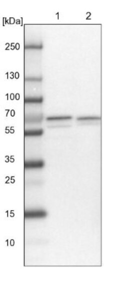 PPIL2 Antibody, Novus Biologicals 0.1mL; Unlabeled:Antibodies, Polyclonal