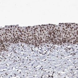 PPIL4 Antibody, Novus Biologicals 0.1mL; Unlabeled:Antibodies, Polyclonal