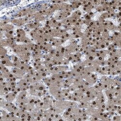 PPM1D Antibody, Novus Biologicals 0.1mL; Unlabeled:Antibodies, Polyclonal