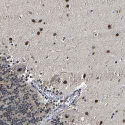 P-Selectin/CD62P Antibody, Novus Biologicals:Antibodies:Primary Antibodies