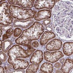 PPM1H Antibody, Novus Biologicals:Antibodies:Primary Antibodies