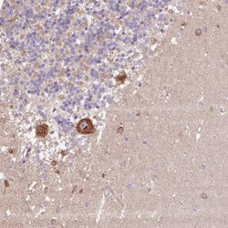 PPME1 Antibody, Novus Biologicals:Antibodies:Primary Antibodies