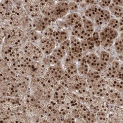PPOX Antibody, Novus Biologicals 0.1mL; Unlabeled:Antibodies, Polyclonal