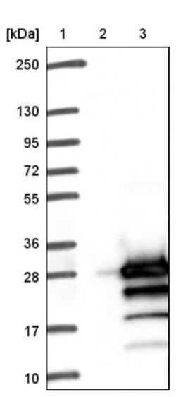 PPP1R14D/GBPI-1 Antibody, Novus Biologicals 0.1mL; Unlabeled:Antibodies,