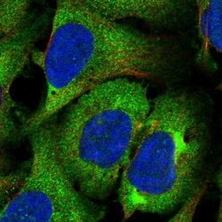 PPP1R32 Antibody, Novus Biologicals 0.1mL; Unlabeled:Antibodies, Polyclonal