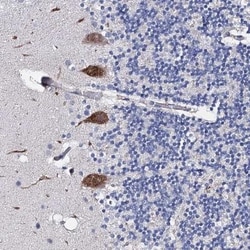 PPP1R32 Antibody, Novus Biologicals 0.1mL; Unlabeled:Antibodies, Polyclonal