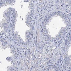 PPP1R32 Antibody, Novus Biologicals 0.1mL; Unlabeled:Antibodies, Polyclonal