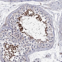 PPP1R32 Antibody, Novus Biologicals 0.1mL; Unlabeled:Antibodies, Polyclonal