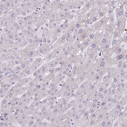 PPP1R35 Antibody, Novus Biologicals 0.1mL; Unlabeled:Antibodies, Polyclonal