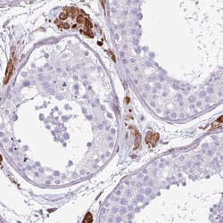 PPP1R35 Antibody, Novus Biologicals 0.1mL; Unlabeled:Antibodies, Polyclonal