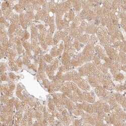 PPP1R3B Antibody, Novus Biologicals 0.1mL; Unlabeled:Antibodies, Polyclonal