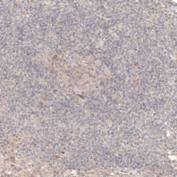 PPP1R3B Antibody, Novus Biologicals 0.1mL; Unlabeled:Antibodies, Polyclonal