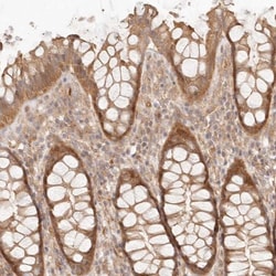 PPP1R3B Antibody, Novus Biologicals 0.1mL; Unlabeled:Antibodies, Polyclonal
