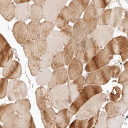 PPP1R3B Antibody, Novus Biologicals 0.1mL; Unlabeled:Antibodies, Polyclonal