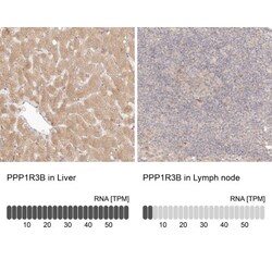 PPP1R3B Antibody, Novus Biologicals 0.1mL; Unlabeled:Antibodies, Polyclonal