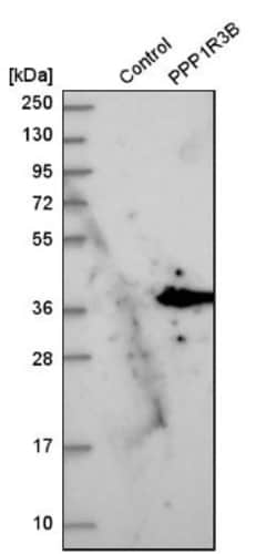 PPP1R3B Antibody, Novus Biologicals 0.1mL; Unlabeled:Antibodies, Polyclonal