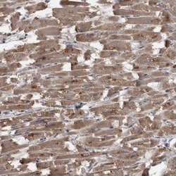 PPP1R3C Antibody, Novus Biologicals:Antibodies:Primary Antibodies