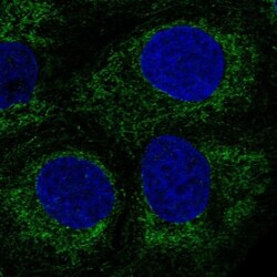 PPP1R3E Antibody, Novus Biologicals 0.1mL; Unlabeled:Antibodies, Polyclonal