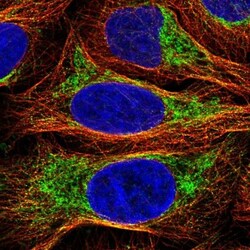 PPP1R3E Antibody, Novus Biologicals 0.1mL; Unlabeled:Antibodies, Polyclonal