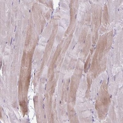 PPP1R3E Antibody, Novus Biologicals 0.1mL; Unlabeled:Antibodies, Polyclonal