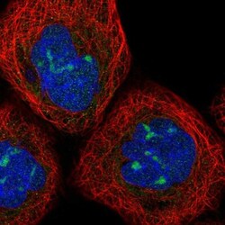 PPP1R7 Antibody, Novus Biologicals 25 &mu;L, Unlabeled:Antibodies, Polyclonal