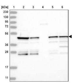 PPP1R7 Antibody, Novus Biologicals 25 &mu;L, Unlabeled:Antibodies, Polyclonal
